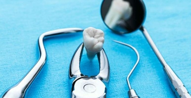Чем занимается хирургическая стоматология
