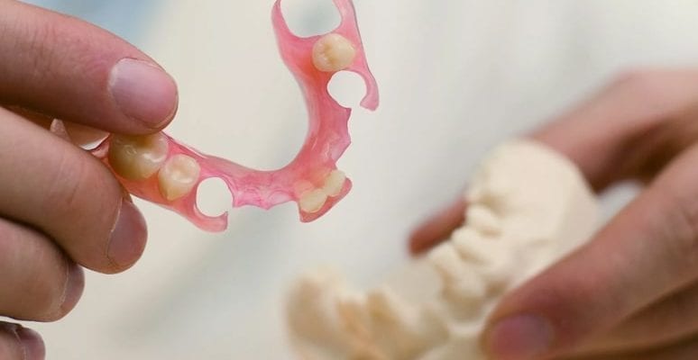 нейлоновый зубной протез